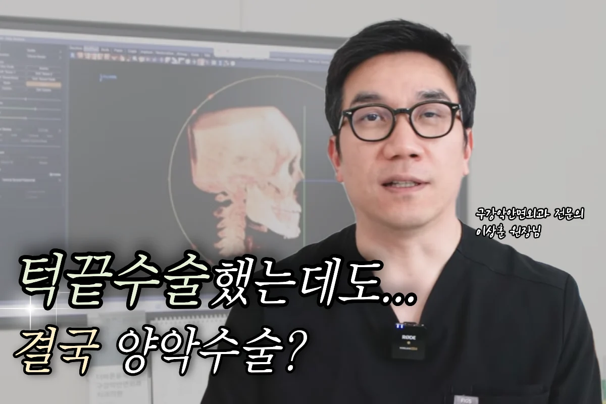 턱끝수술만으로 턱이 들어갈까? 정상교합 양악수술 케이스 (이부후퇴술 한계)