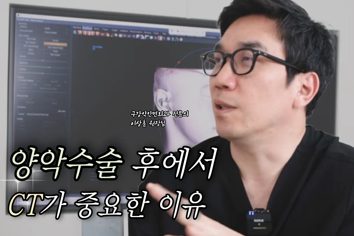 3D CT, 양악수술 시뮬레이션, 안면윤곽수술, 디지털 수술 계획
