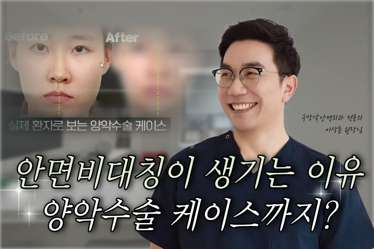 안면비대칭이 생기는 이유, 양악수술 케이스까지